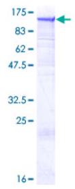 SDS-PAGE (DNM2-2786H).jpg